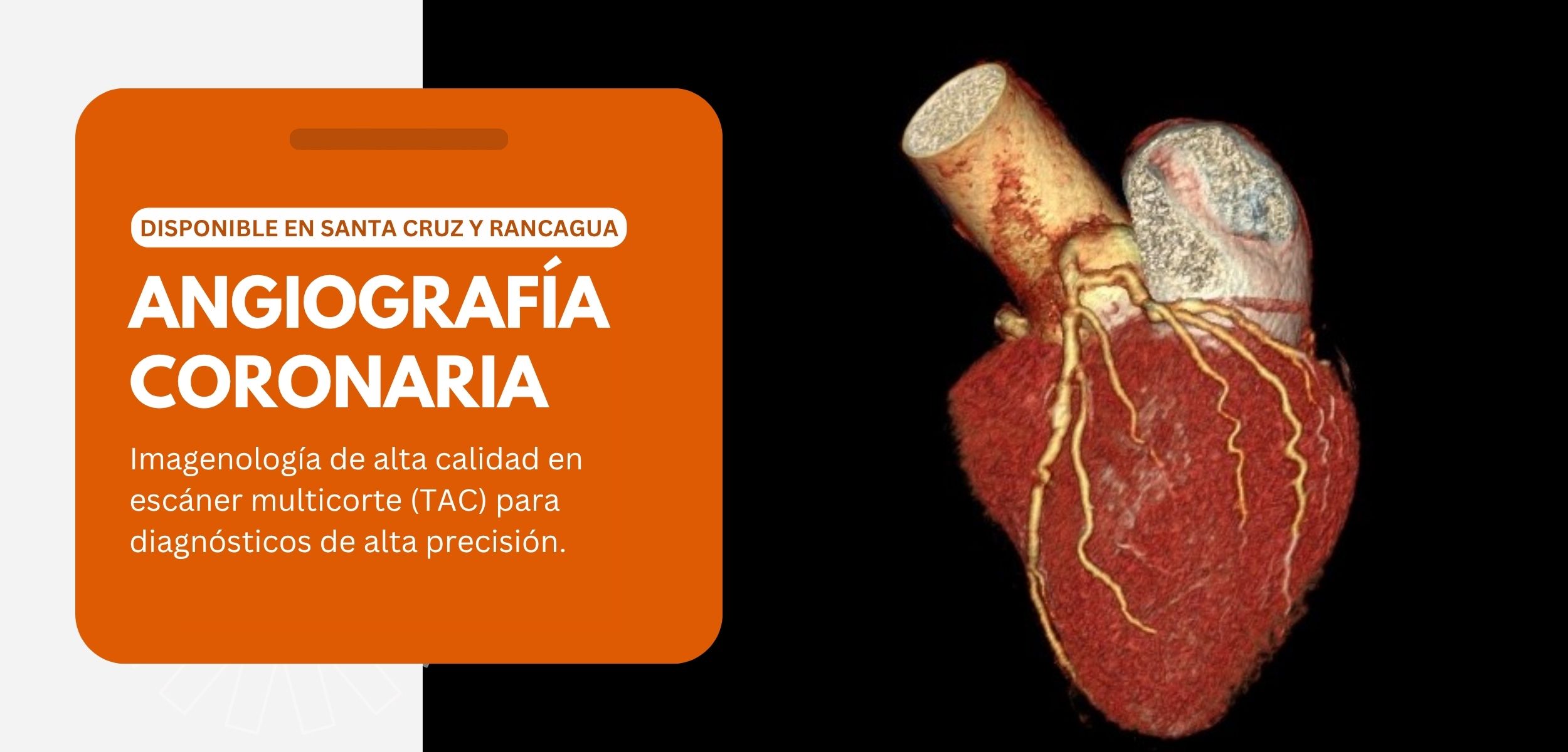 Angiografía coronaria imagenología San Lorenzo