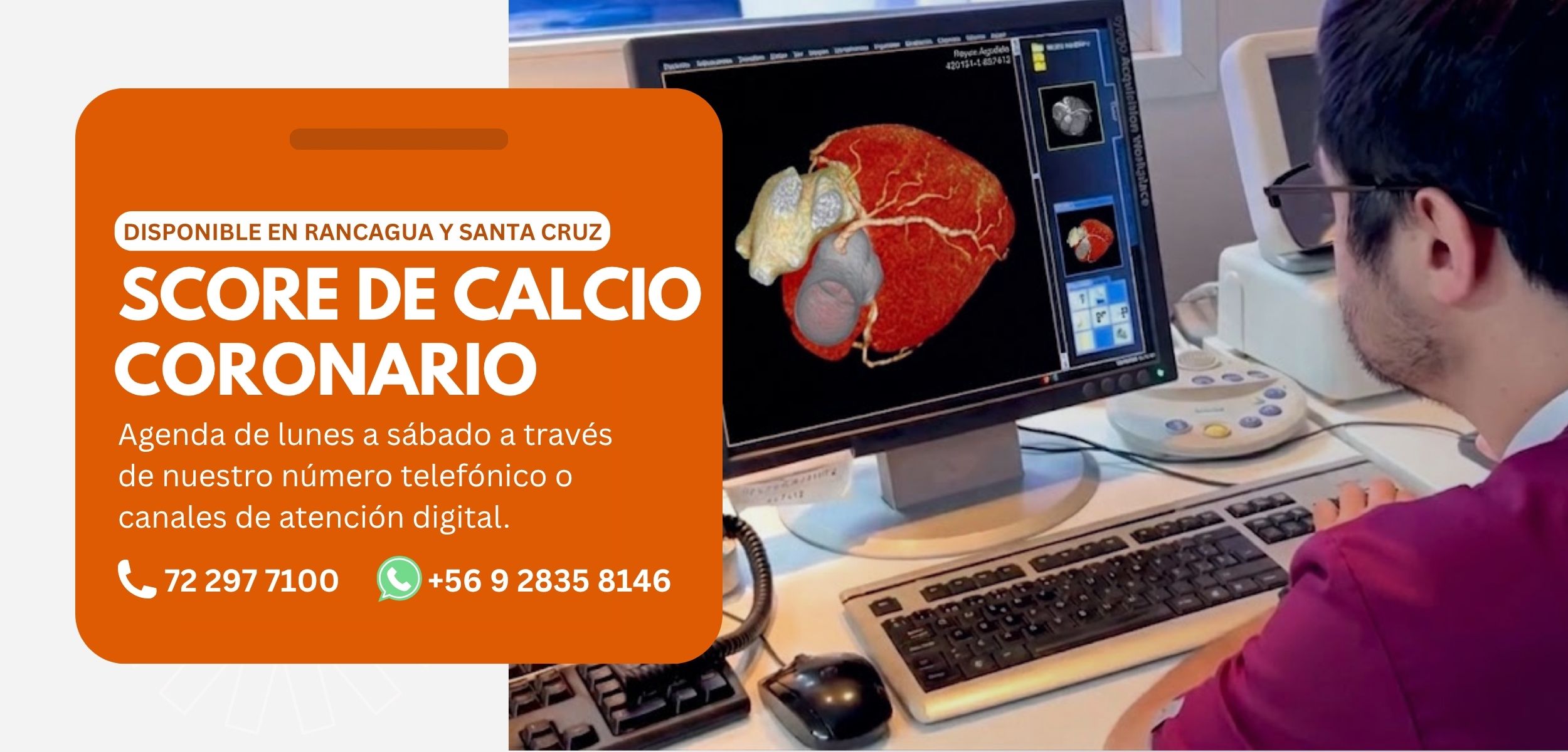 escáner en arterias coronarias imagenología San Lorenzo